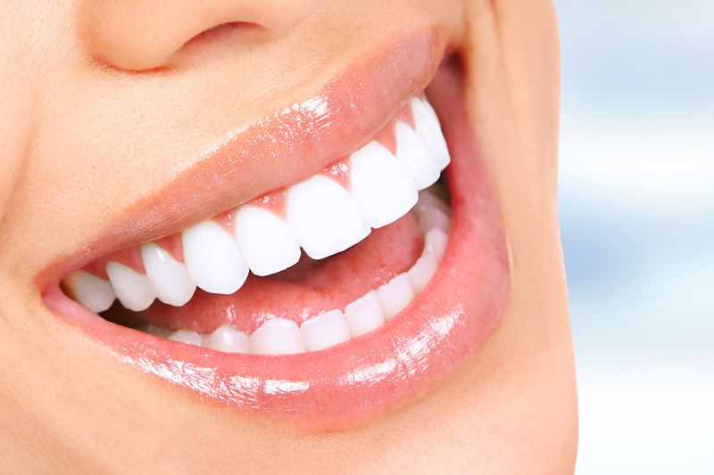 Cosmetic Dentistry in Rancho Bernardo