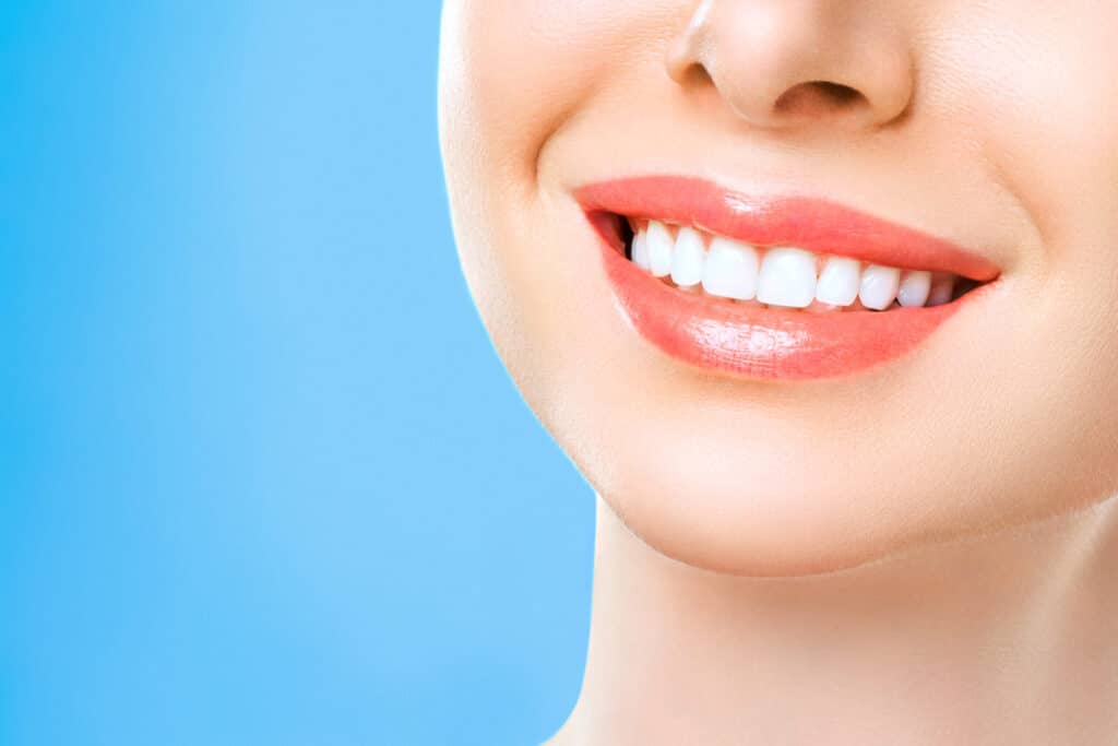 Teeth Whitening Right for You? ​