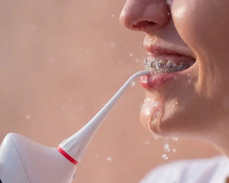 Dental Cleaning at Plaza Dentistry