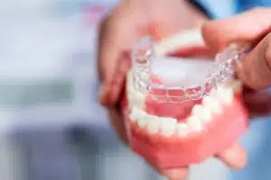 Invisalign Treatment Process for Rancho Bernardo Patients